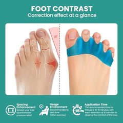 Silicone Toe Separators for Correct Bunion – 8 Pack Toe Spacers for Feet Men