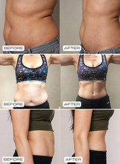 Pilates Reformer Set – All-In One Workout To Help You Sculpt & Tone From Home !