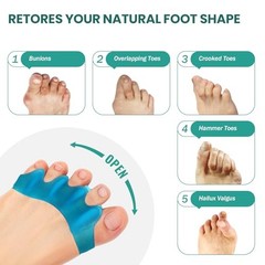 Silicone Toe Separators for Correct Bunion – 8 Pack Toe Spacers for Feet Men